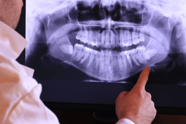 Best Pediatric Emergency Dentist in Oak Hill, TN