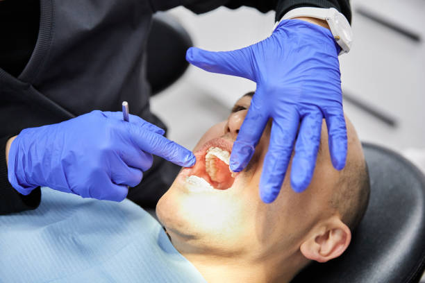 Best Emergency Root Canal Treatment in Oak Hill, TN